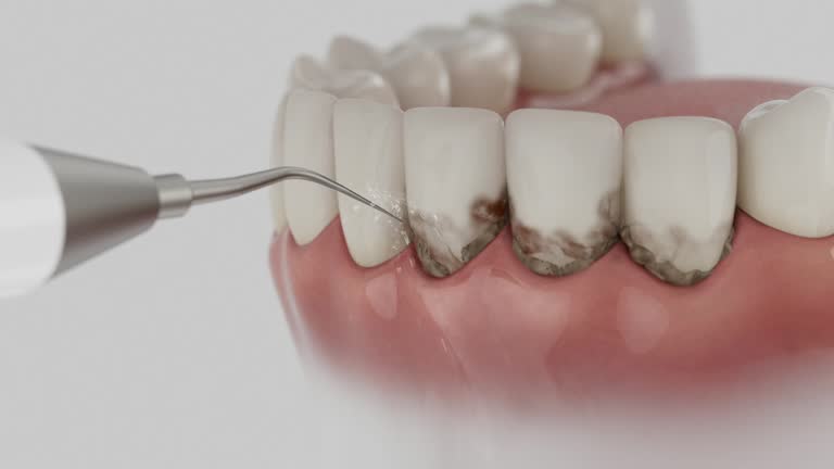 Reliable Dental contractor in Hercules, CA by Dentist Open Now